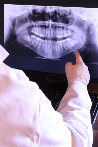 Best Emergency Dental Services for Seniors in Santa Rosa, CA