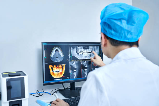 Best Broken or Cracked Tooth Emergency Dentist in Santa Rosa, CA