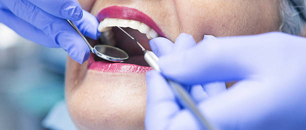 Best Orthodontic Emergency Dentist in Santa Rosa, CA